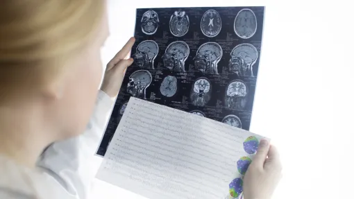 Fotografía de una mujer mirando unas tomografías computarizadas del cerebro